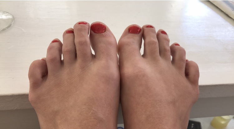 naglar - Vilket år - 2017!