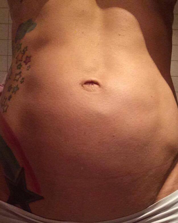 15934612_398503780496512_1906299390_n - Varför vi måste prata mer om magdelning efter graviditet