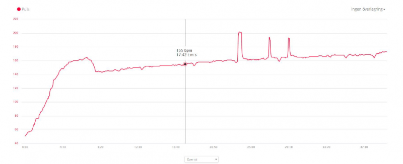 Ska%CC%88rmavbild%202016-09-29%20kl.%2010.04.35 - akut, ambulans, flimmer, hjärta, hjärtstillestånd, idrott, pacemaker