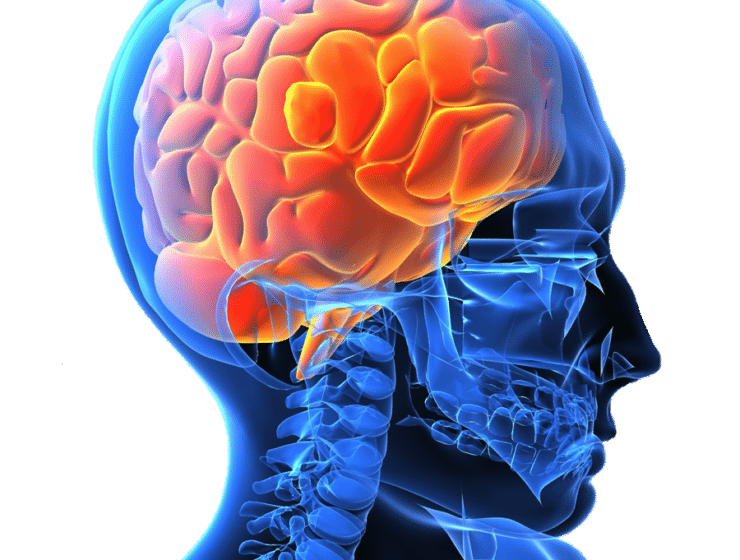 Livsstilsförändrande metod kan minska risken för stroke och ohälsa