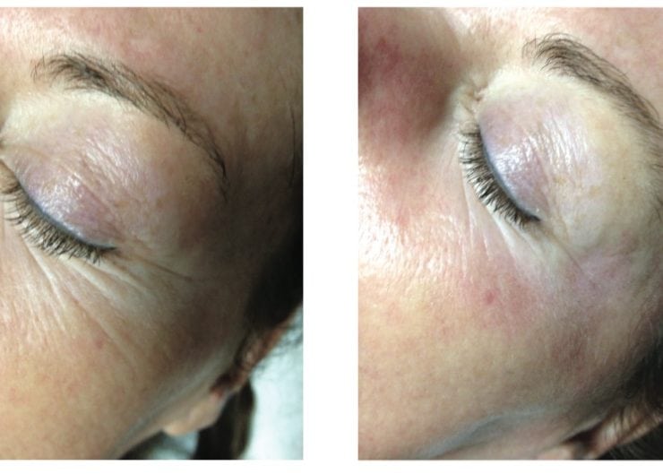 Säker skönhet med resultat