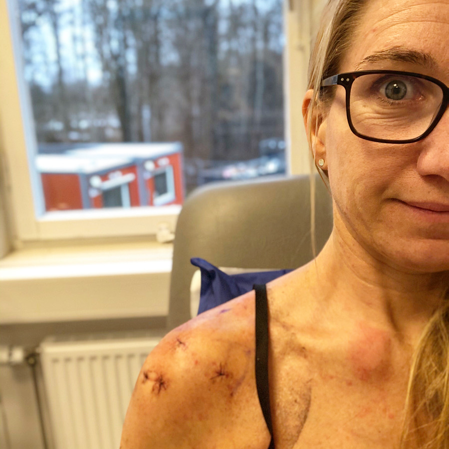 Stygnen tas bort