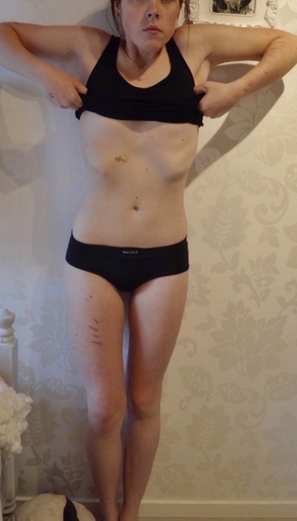 IMG_1002 - Länge sedan No see - BULIMIA STORY TIME