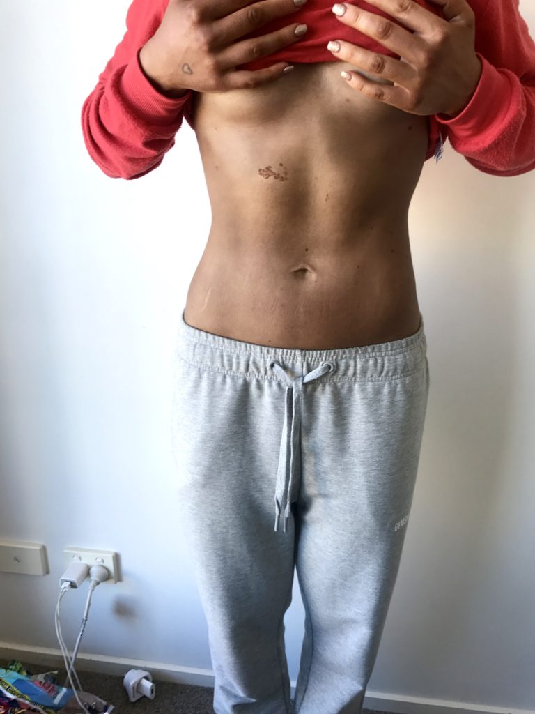 IMG_8946-1-768x1024 - Bulimi + tävlingsdiet?!