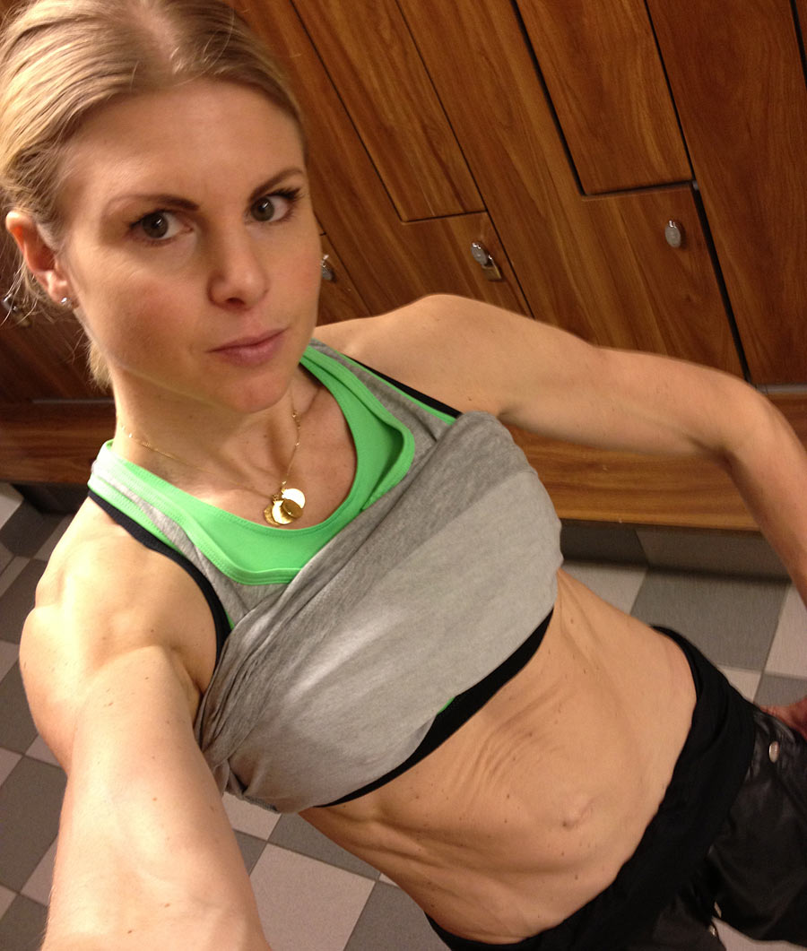 mage_diastas mage_diastas - Magplåtning