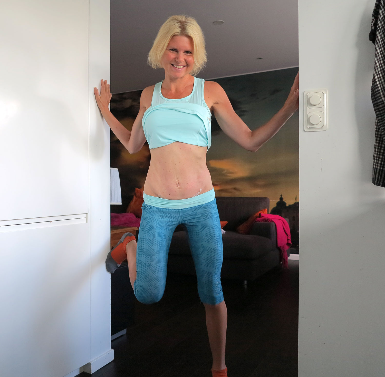 5manef_diastasop - diastasoperation