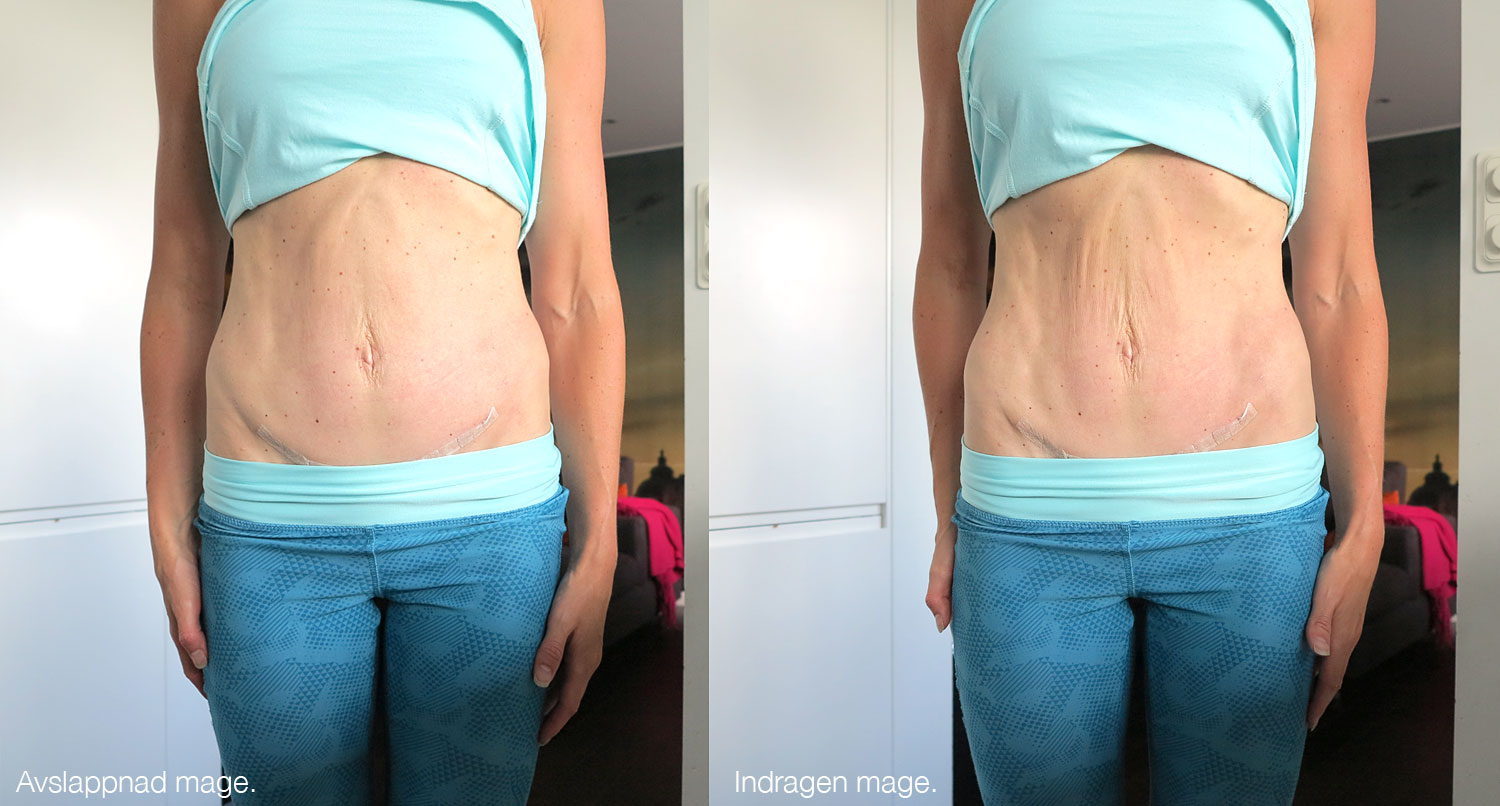 5manpostdiastas - diastasoperation