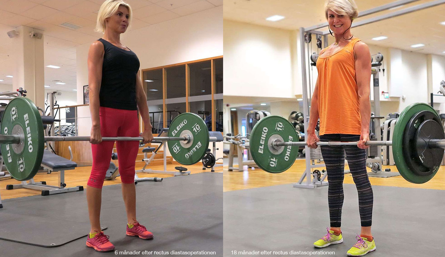 marklyft_efter_diastasoperation