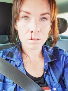 20200815_163947-225x300 - ohälsa